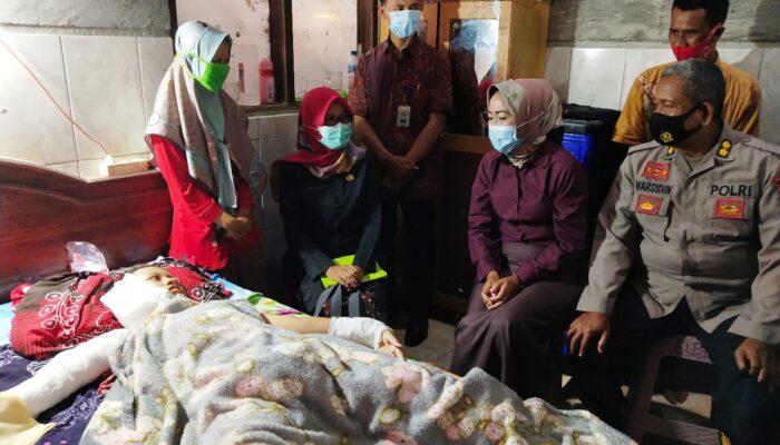 Memprihatinkan, Siswi SMK Korban Penyiraman Air Keras Dirujuk ke RSUD Brebes