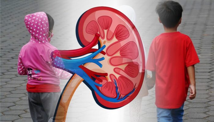 Waduh, Lima Anak di Jawa Tengah Terpapar Gagal Ginjal Akut