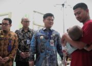 RSUD dr Soesilo Slawi Gelar Bakti Sosial Operasi Bibir Sumbing dan Langit-Langit